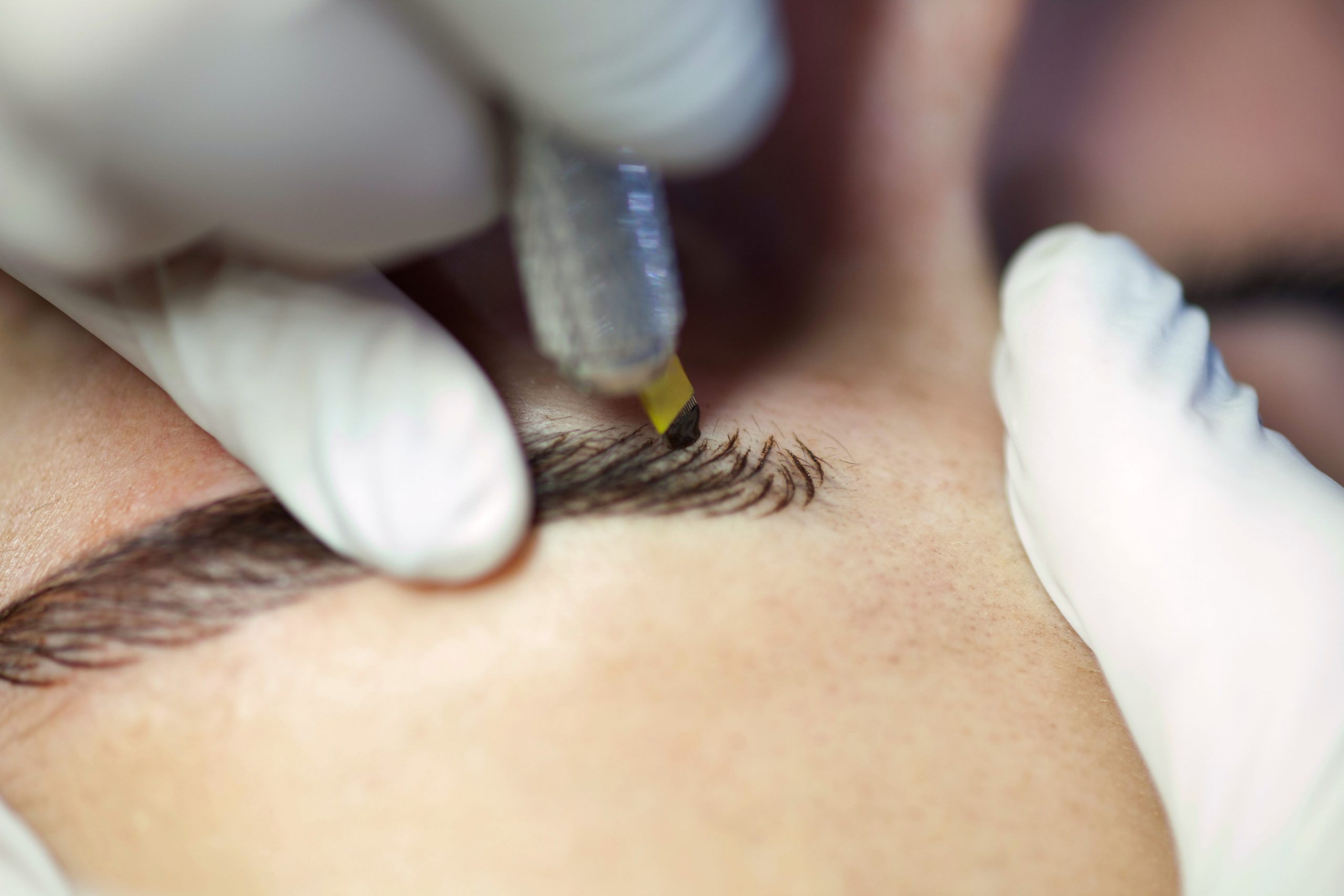 The ultimate guide to cosmetic eyebrow tattooing
