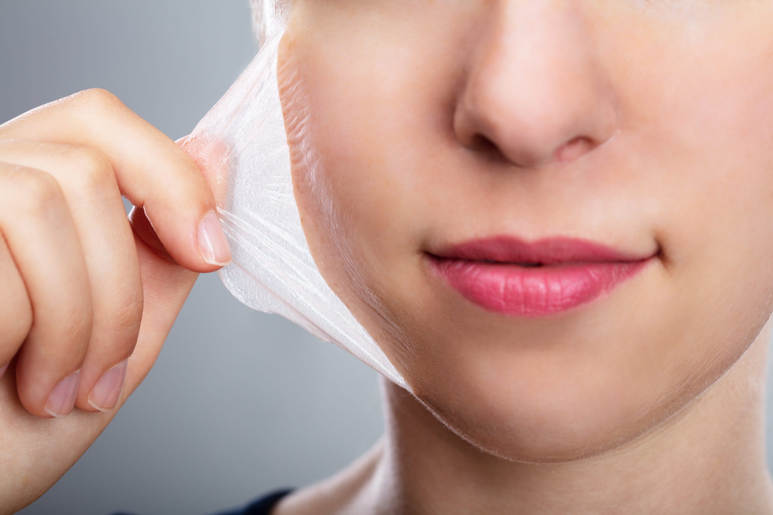 Here's why chemical peeling is the secret to perfect skin