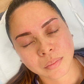 Treatment image 1