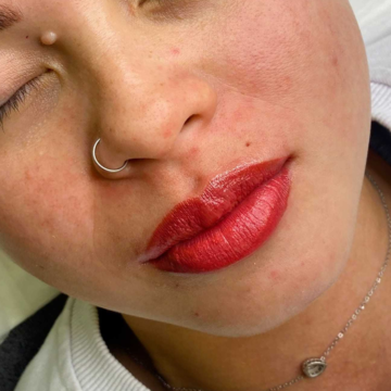 Treatment image 2