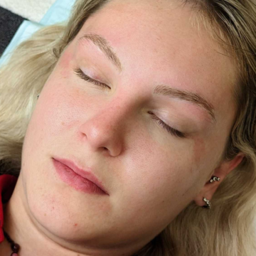 Treatment image 3