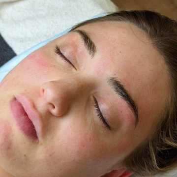 Treatment image 2