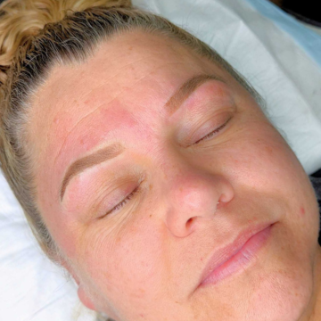 Treatment image 2