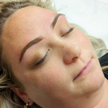 Treatment image 3