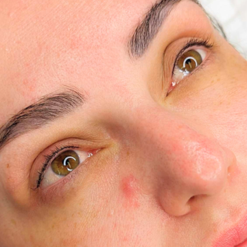 Treatment image 4
