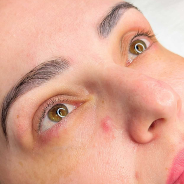 Treatment image 3